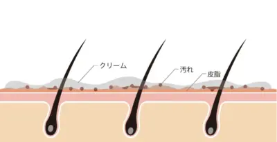 step-01.webp